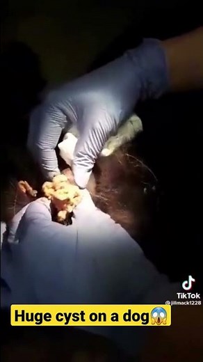 HUGE cyst on a dog 😱 popping HUGE blackheads and pimples | pimple popper | best videos | cyst & acne