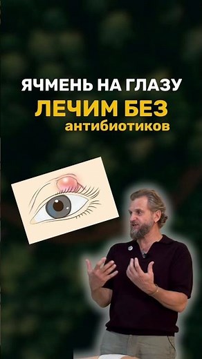 Ячмень на глазу: в чем реальная причина его появления? #глаза #здоровье #зож #лечение #организм