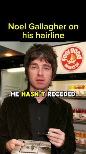 Noel Gallagher on his hairline #britpopmusic #music #oasis #noelgallagheredit #noelgallagheroasis
