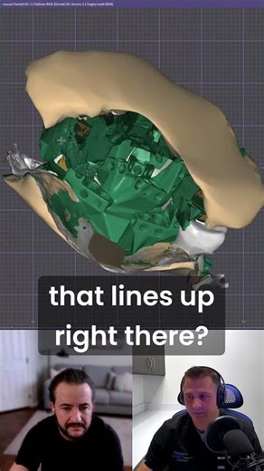 Dr. Michael Cimino drops pure exocad wisdom, why it’s worth your chair time!