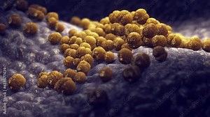 Meningitis bacteria animation, Neisseria meningitidis. Meningococcal meningitis is a bacterial form of meningitis, a serious brain infection