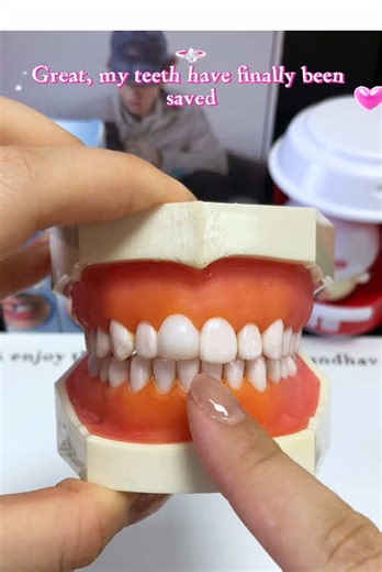 Moldable Dental Gel for Temporary Fillings: A Solution for Missing Teeth