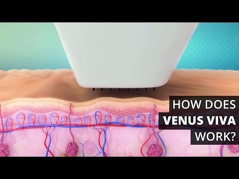 How Does Venus Viva™ Work?