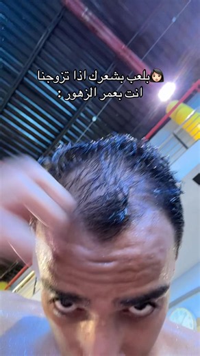 ‏المشكله عندي حسسيه من المونيكسدل 😔 #fyp #foryou #foryoupage | Styling Cream For Hair