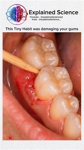 😱 This Tiny Toothpick Habit Is Secretly Destroying Your Gums! 🦷⚠️ #shorts #DentalHealth #TeethFacts