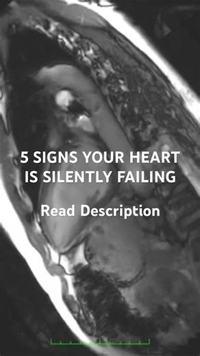 5 SIGNS YOUR HEART IS SILENTLY FAILING