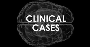 Pseudobulbar and bulbar palsies