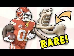 Tyreek Hill Hospitalized with RARE Shoulder Injury! Doctor Explains SC Dislocation