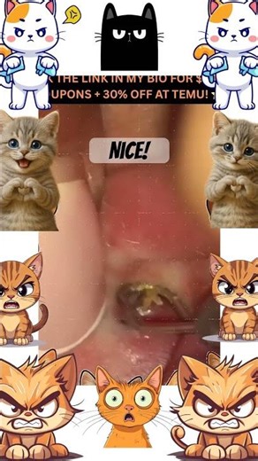 Huge pimple sqiorts everywhere