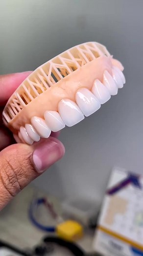 ‏#dental #explore #technician #dentallaboratory