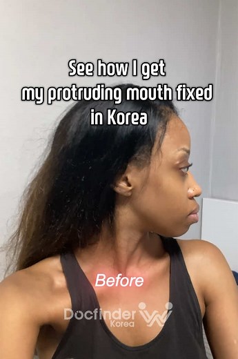 Korean Surgeons Transform Faces with Advanced Techniques