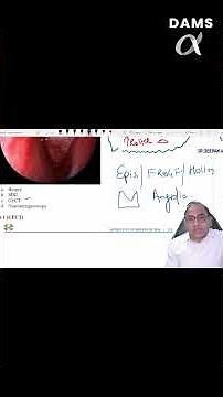 DAMS Brain Zap - ENT