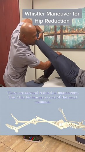 Whistler Maneuver Method for Hip Dislocation Explained