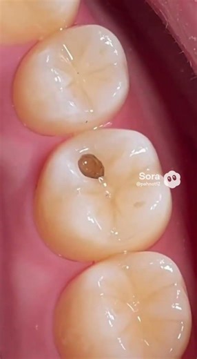 #dentalcare #dentist #oralhealth #healthysmile #smilebright #dentistadvice #doctoradvice #flossdaily