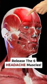 These 6 HEADACHE Muscles will give you Relief when you Try This! #headaches #headacherelief #neck