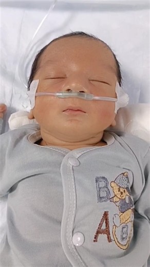 🥺🫁👶 A Big Baby Facing a Tough Breathing Battle 💔 | Severe RDS in NICU ❤️‍🩹💙