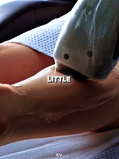 Understanding How Laser Hair Removal Works