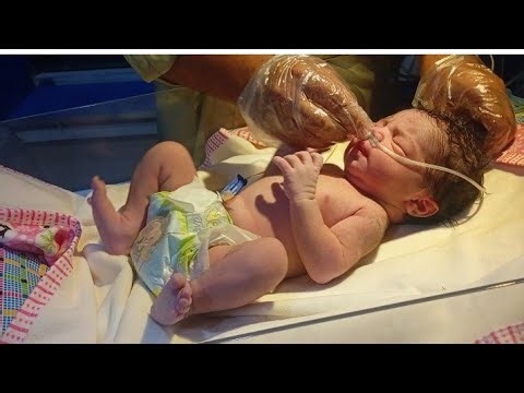 FIRST BABY NICU PROTOCOL | WEIGHT AND RBS CHECKING