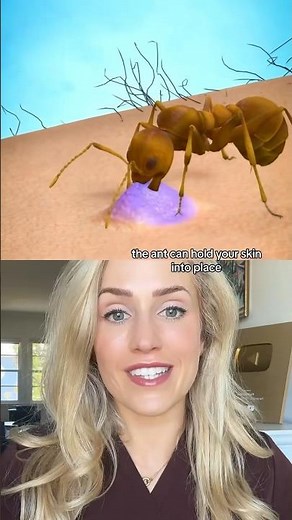 Doctor explains: do ants actually bite? ‪@zackdfilms‬