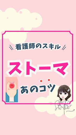 看護師ゆいぴ⌇【元ブラック大学病院8年勤務】 on Instagram: "ストーマパウチ効 交換のコツ☝️ @yuipi_nurse▶︎フォローはこちら👀 . . 看護師のみんな😳✋ ストーマのパウチ交換。 色々なアイテムがありますよね！ . . 消化器外科じゃないからいいやって 安心するのは危険です⚠️ . . ストーマを形成されてる患者さんが 違う疾患で入院してくるコトがあるよね！ . . 看護師なら押さえておきたいアイテム！ リング状になっているのは、皮膚保護剤リングです！ . . ▪︎ストーマと面板のすきまをうめて 便が漏れないようにするコト！ 皮膚が直接、便に当たらず 皮膚トラブルを予防できる効果があります！ . . 使い方の方法は様々です✨ 色々な使用方法ができること覚えておきましょう！ . . 他にも看護の知識を発信してるよ✨ @yuipi_nurse▶︎フォローはこちら👀 . #看護師#看護師辞めたい#看護師の勉強垢#新人看護師"