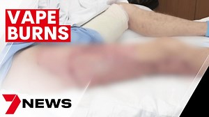Vape explodes in man's pocket, setting him on fire leaving horrific scars | 7NEWS - The Global Herald
