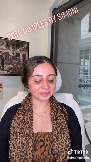 Beverly Hills on TikTok