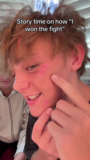Story Time on how I got JUMPED!! #fight #kadeskye #fyp #trending #funny