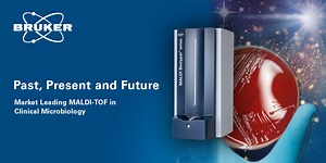 The Market Leading MALDI Biotyper ® CA System:  Past, Present and Future