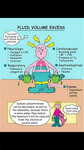 24K views · 152 reactions | Fluid volume excess #viralreelschallenge #medicalstudent #diseases | Surgi Cal Tec | Facebook