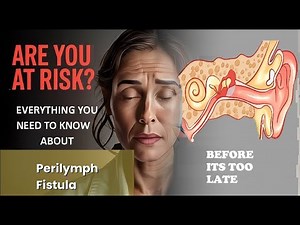 Perilymph Fistula Explained Causes, Symptoms and Treatment, All Insights