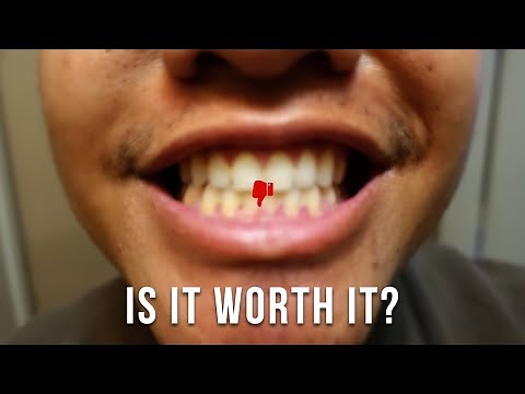 CREST GUM DETOXIFY + WHITENING TOOTHPASTE Review!