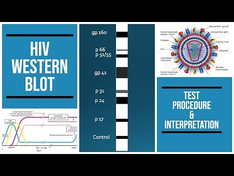HIV western blot | SDS gel | procedure | Interpretation | #pathology #pathologylab #biochemistry