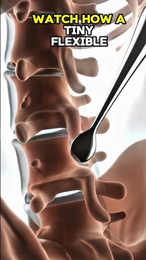 The Miracle of Epidurals: 3D Visualization 🧬