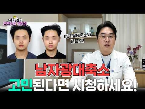 남자 광대축소, 고민된다면 시청하세요!│옆광대, 45도광대, 뒷광대│입체성형외과 조현우 원장