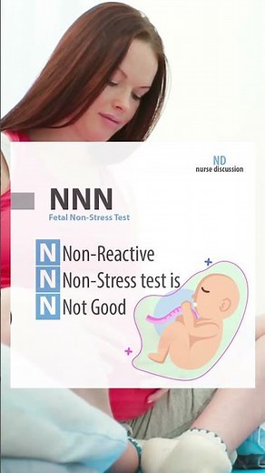 3 NNN : Fetal non stress test