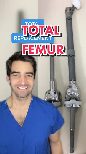total femur replacement #learnontiktok