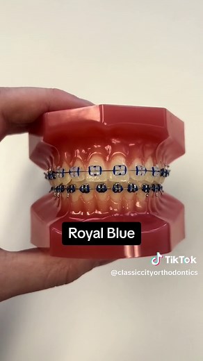 Braces Colors: Ideas & Tips to Avoid Staining