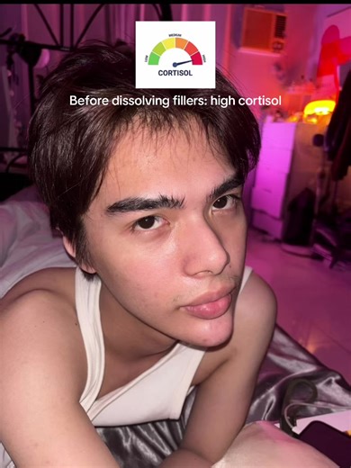 Renzo Angeles (@renzuwuu)’s video of Cortisol