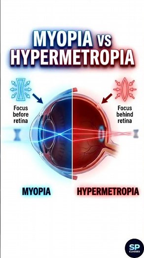 Defects of Vision Explained in 60 Sec | Myopia & Hypermetropia #shorts #Physics #10thphysics