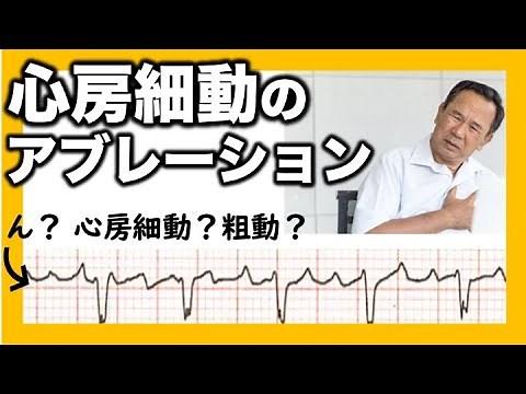 心房粗動 (Atrial flutter) 通常型心房粗動 (Common AFL) 非通常型心房粗動 (Uncommon AFL) 心電図