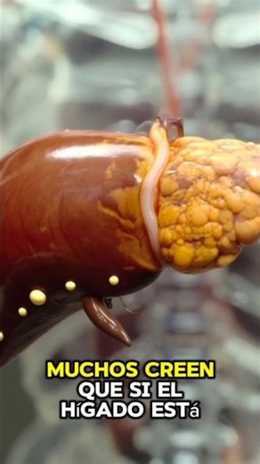 3 signs your liver isn't working properly 😱
