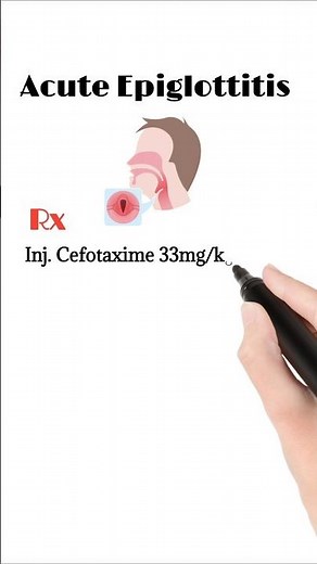 Acute Epiglottitis Treatment