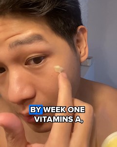5 reasons why you'll love ZENITH Anti Aging Tallow Cream using only verified customer reviews! 1️⃣ Reduces fine lines and wrinkles! “Nakaka-amaze itong ZENITH Anti-Aging Tallow Cream! Matagal ko nang hinahanap yung product na kayang i-smooth out yung mga wrinkles ko sa forehead at eye area, at ito na yun. Sobrang lambot ng balat ko ngayon, parang bumata ako ng ilang taon. Ang bilis mag-absorb at hindi malagkit sa pakiramdam!” 2️⃣ Fast acting! “Hindi ko in-expect na ganito kabilis mag-effect. Pim