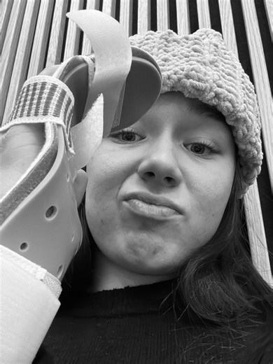 alina ❄︎ | ~Shit happens 🤕✨~ Turns out smashing my hand into the goalpost threads wasn’t my best idea. Broke my index metacarpal (index finger) into... | Instagram
