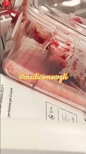 “This Heart Is Beating Outside the Body ❤️ | Organ Care System Explained | Medical Miracle”