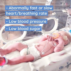 1.5K views · 18 reactions | Do you know the key signs of early-onset group B Strep infection? Watch our video to find out more on GBS infections in newborns. #GBSAM2021 | Group B Strep Support (GBSS) | Facebook