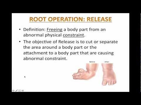 Lesson 3 - Root Operation: Release