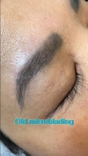 How to remove microblading