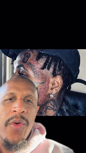 Mr. Ferrari Media on Instagram: "When NBA YoungBoy posted that photo, the internet did what it always does. Zoomed in. Screenshotted. Overanalyzed. People noticed a rash on his face and immediately jumped to conclusions. STD jokes. Wild theories. No facts. Just speculation moving at internet speed. Nobody stopped to ask basic questions. Could it be irritation? Allergic reaction? Skin condition? Nope. Social media doesn’t wait for answers. It picks the most shocking option and runs with it. One p