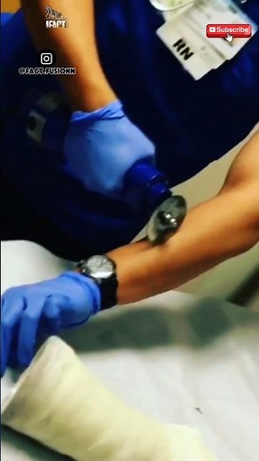 How Do Doctors Cut Off a Cast Without Hurting the Skin?